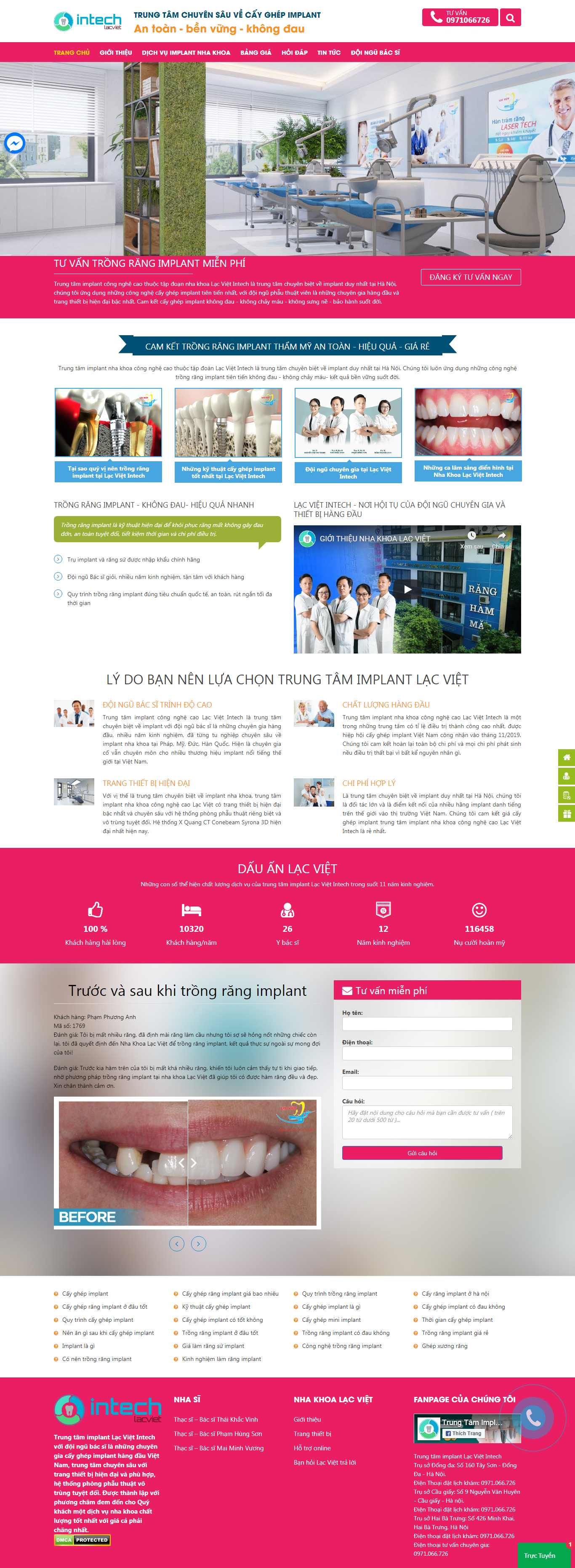 Thiết kế Web Quảng Bình - lamrangimplant.com