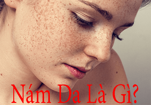 Nám Là Gì? Cách Chữa Trị
