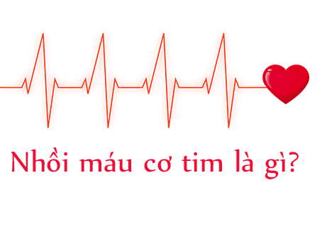 Nhồi máu cơ tim là bệnh gì? Thông tin cần biết