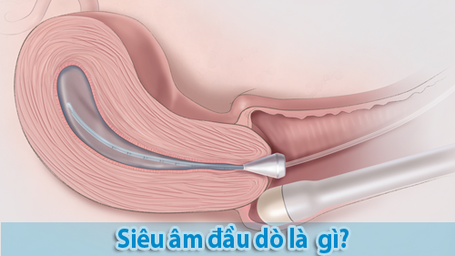 Siêu Âm Là Gì? Tìm Hiểu Về Siêu Âm Là Gì?