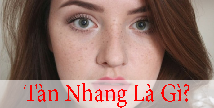 Tàn Nhang Là Gì? nguyên Nhân Và Cách Chữa Trị Tận Gốc