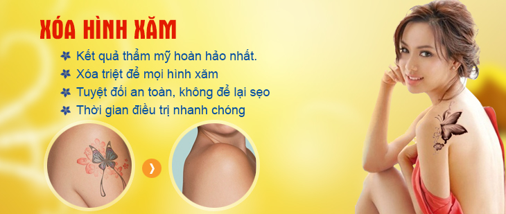 Tìm Hiểu Công Nghệ Xoá Xăm Laser Là Gì?